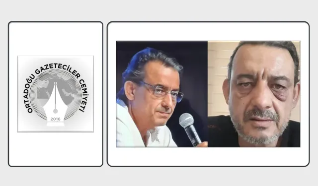 OGC Genel Başkanı Aydın, Gazeteci Hakan Sataroğlu’na Yapılan Saldırıyı Kınadı!